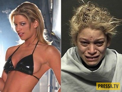 ТОП-10 страшных фото "до и после", которые убедят вас никогда не пробовать наркотики (10 фото)