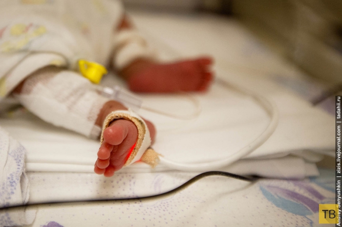 Как спасают новорожденных (21 фото)