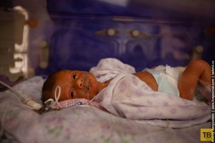 Как спасают новорожденных (21 фото)