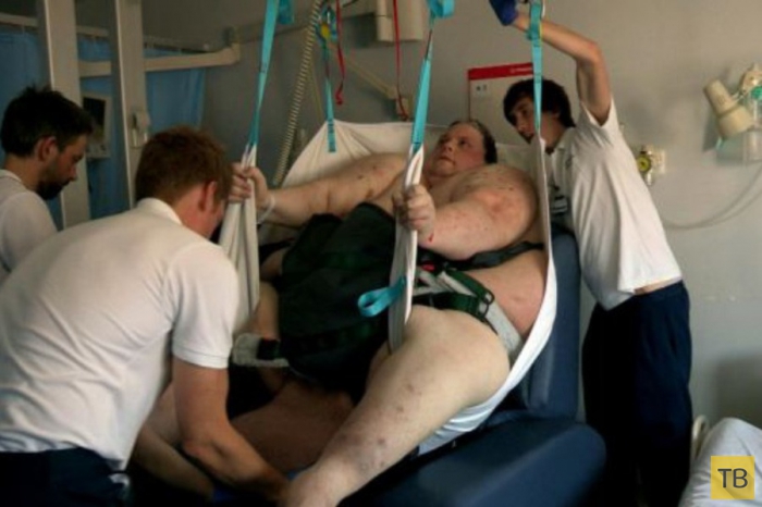 В Англии скончался самый толстый в мире человек (8 фото)