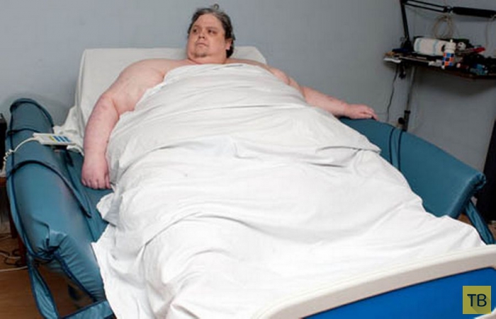 В Англии скончался самый толстый в мире человек (8 фото)