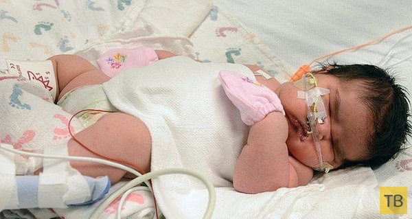 В Колорадо родилась девочка весом 6,3 килограмма (10 фото)