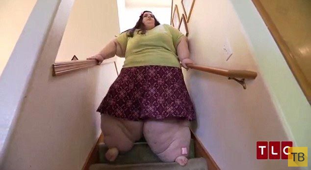 34-летняя американка Эмбер весит 300 кг (5 фото)