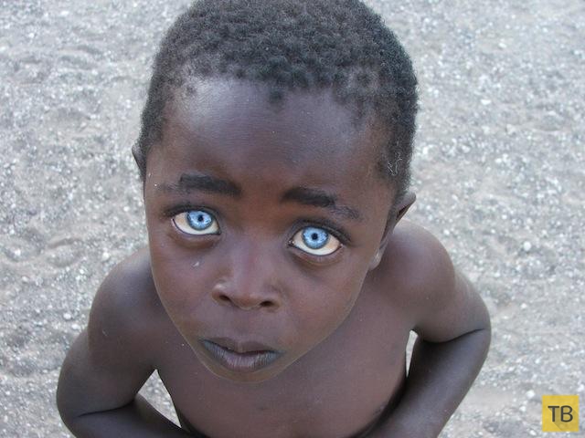 Необычные по красоте глаза людей (10 фото)