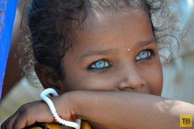 Необычные по красоте глаза людей (10 фото)