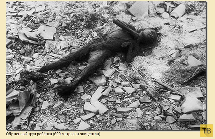 Последствия атомной бомбардировки японских городов Хиросимы и Нагасаки (53 фото)