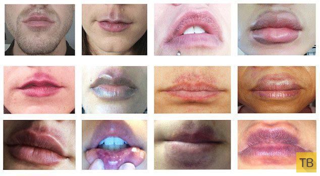 Средство "CandyLipz" - пухлые губы на час, и какую опасность оно несет (12 фото)