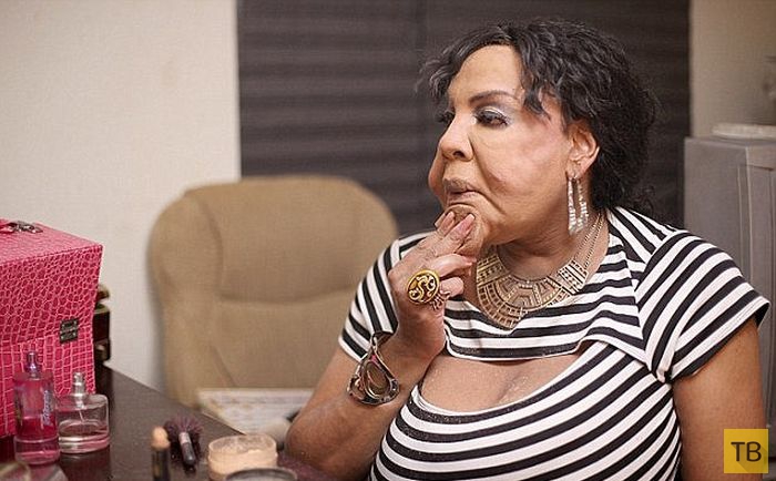 Женщина-трансгендер Раджи Наринесинг обрела новое лицо (7 фото)