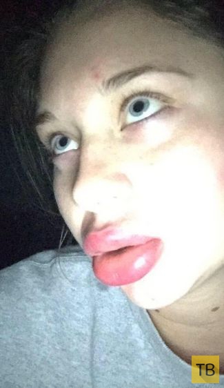 Интернет-флешмоб Kylie Jenner Challenge - увеличение губ подручными средствами (19 фото)
