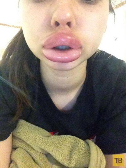 Интернет-флешмоб Kylie Jenner Challenge - увеличение губ подручными средствами (19 фото)