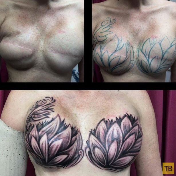 Как татуировкой скрыть шрамы от мастэктомии (8 фото)