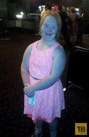 18-летняя австралийка с синдромом Дауна стала моделью (7 фото)