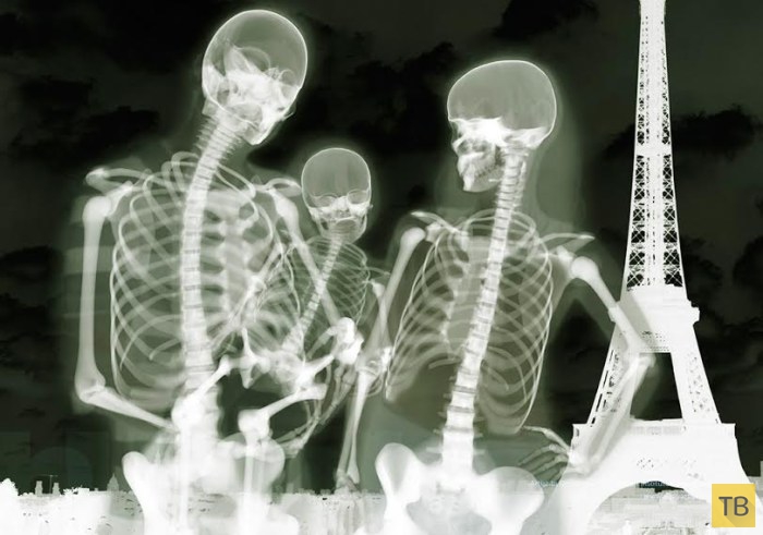 Необычные фотографии: люди в рентгеновских лучах (14 фото)
