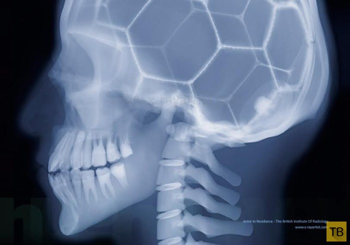 Необычные фотографии: люди в рентгеновских лучах (14 фото)