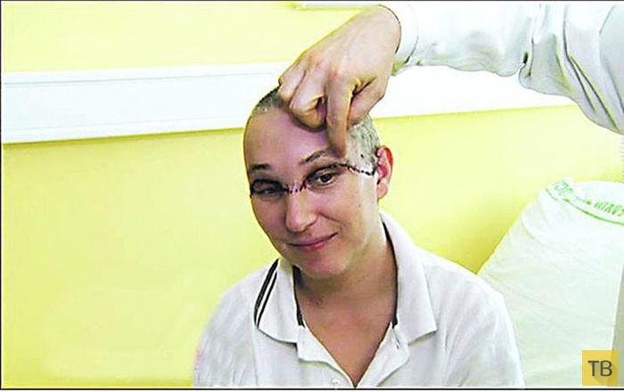 Топ 5: Самые невероятные операции на голове (7 фото)