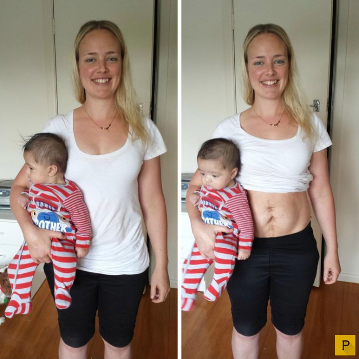 Как менялось тело женщины после родов  (7 фото)