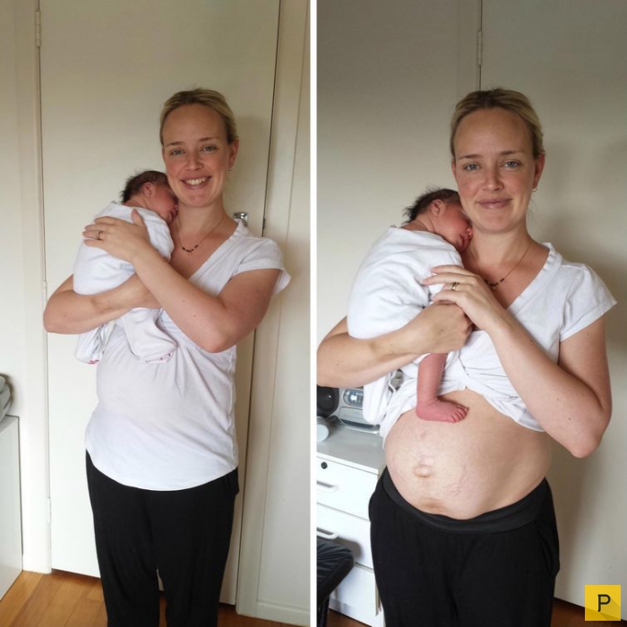 Как менялось тело женщины после родов  (7 фото)