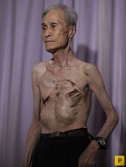 86-летний житель Нагасаки, выживший после ядерной бомбардировки (10 фото)