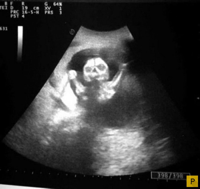 Жуткие узи беременных (10 фото)