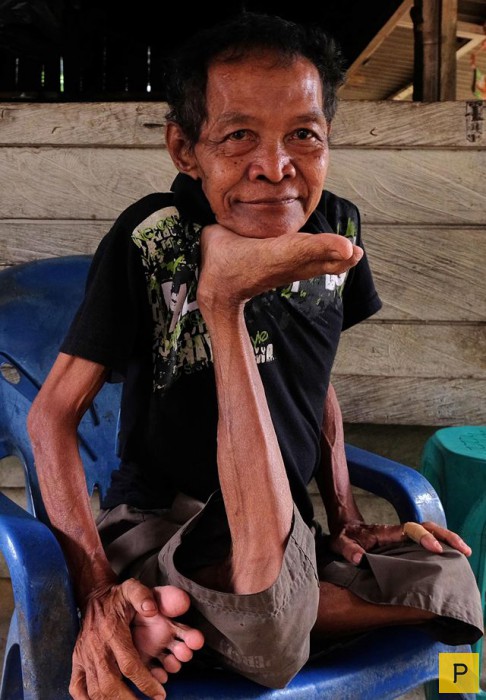 У 68-летнего индонезийца необыкновенно гибкие суставы (12 фото)