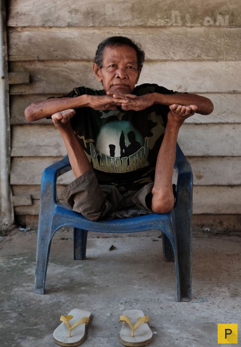 У 68-летнего индонезийца необыкновенно гибкие суставы (12 фото)