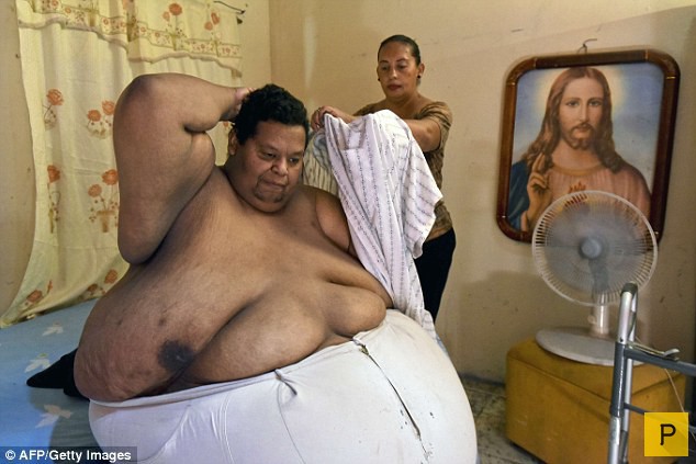 Оскар Васкес Моралес - самый толстый человек Колумбии (6 фото)