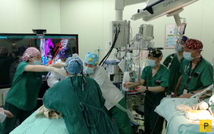 Китайские врачи провели успешную операцию по разделению сиамских близнецов с применением новых технологий (13 фото)