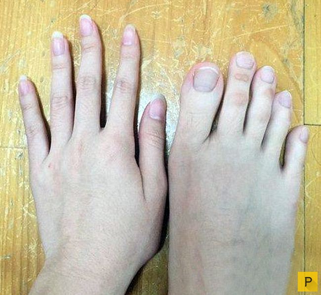 Необычные Ноги Фото