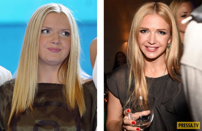 Юлия михальчик до и после пластики фото