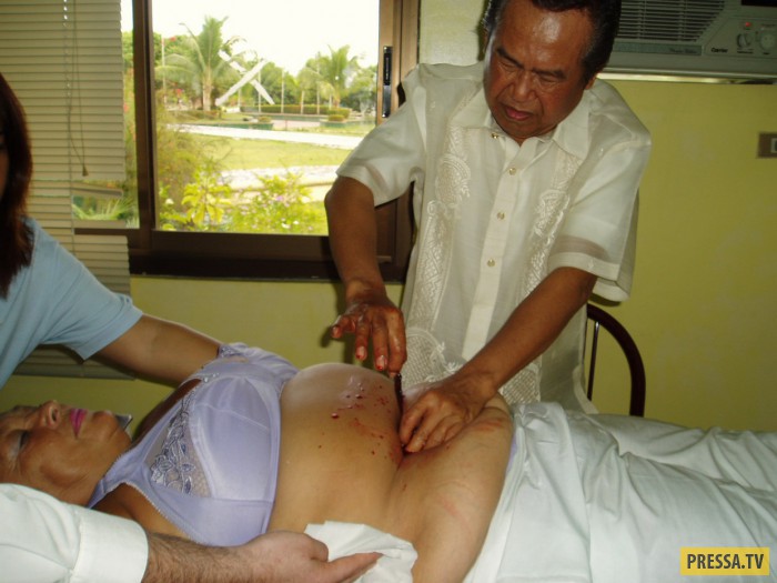 Филиппины лечение позвоночника у хилеров