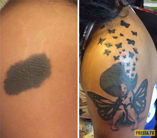 Татуировки, гениально маскирующие родимые пятна