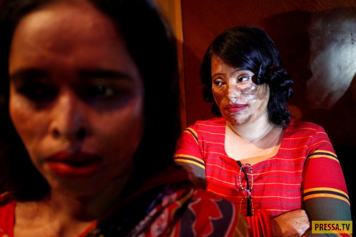 Женщины, пострадавшие от кислотных, атак провели показ мод (15 фото)