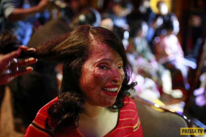 Женщины, пострадавшие от кислотных, атак провели показ мод (15 фото)