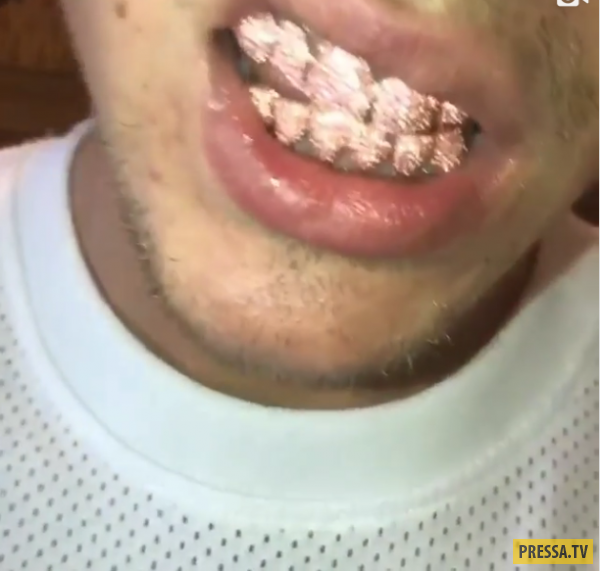 Певец Джастин Бибер сверкнул розовыми зубами из золота и сапфиров (4 фото)