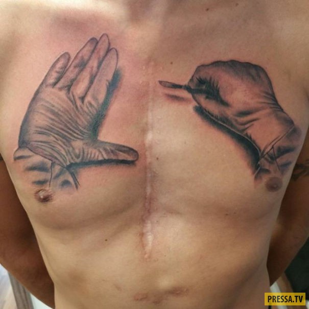 Удивительные тату, превращающие шрамы в произведения искусства (89 фото)