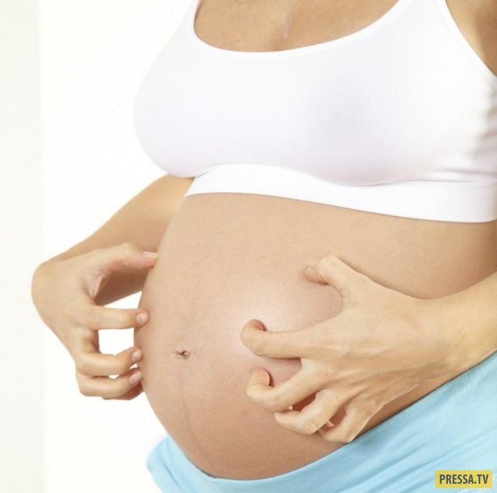 ТОП-10 удивительных и странных изменений тела женщины во время беременности (10 фото)