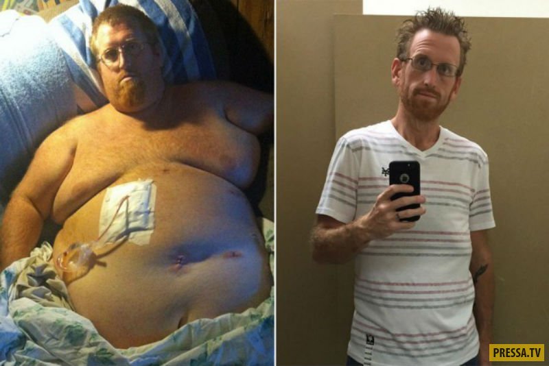 36-летний Зак Мур чуть не умер от обжорства и похудел на 158 кг (9 фото)