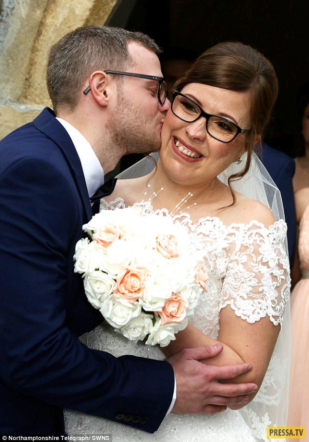 Чудеса бывают: британка, которая родилась с уродством на лице, вышла замуж! (7 фото)