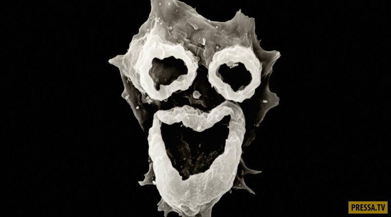Амеба Неглерия Фоулера (Naegleria fowleri), которая питается мозгом (6 фото)