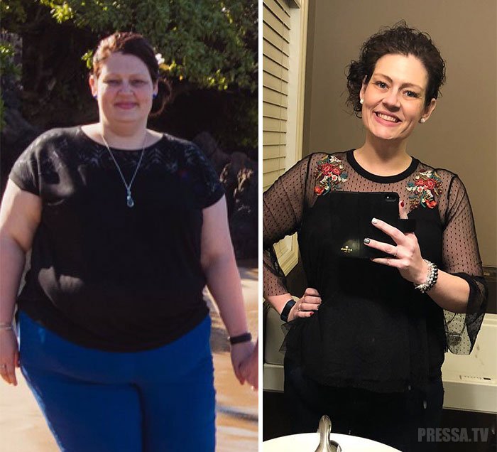 Женщина похудела на 68 кг , следуя советам своего диетолога