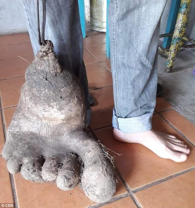 Бразильский фермер вырастил картошку в форме человеческой стопы