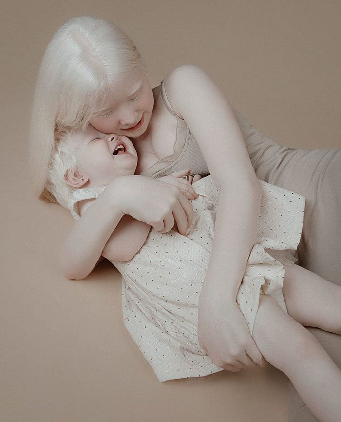 Сестры-альбиносы ошеломляют мир  необычайной красотой