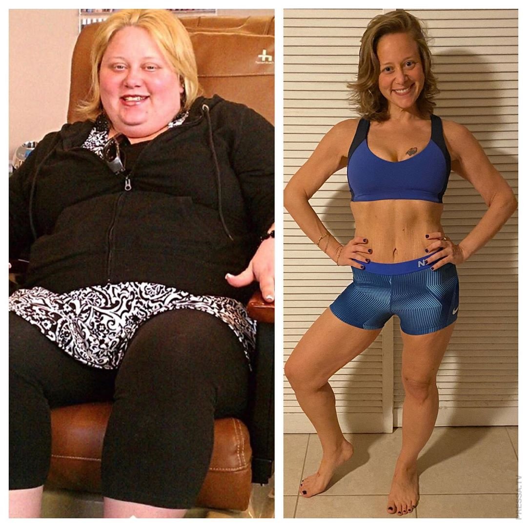 20 кг 40 60 100. Похудение до и после. Похудение для женщин. До и после похудения женщины. Сильное похудение.
