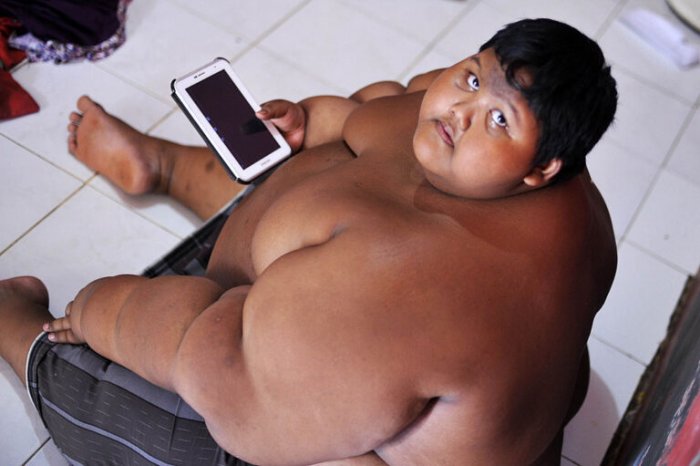 Самый толстый в мире мальчик похудел на 110 кг