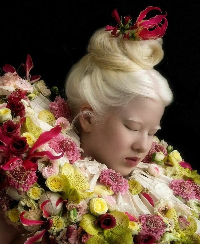 Брошенная в младенчестве из-за альбинизма Сюэли выросла, чтобы стать моделью Vogue