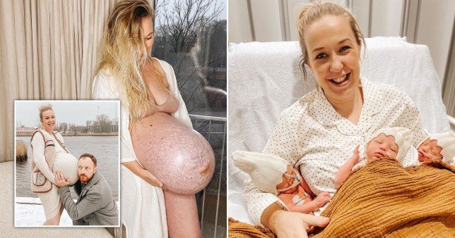 Беременная женщина хвастается «уникальным» животиком на 35 неделе