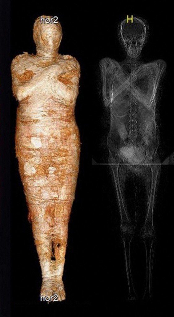 Египетская мумия с 28-недельной беременностью, которая сохранялась 2000 лет