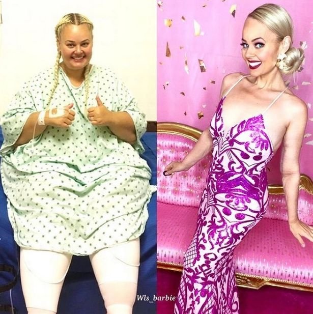 Полная женщина превратилась в «реальную Барби», похудев на 90 килограмм