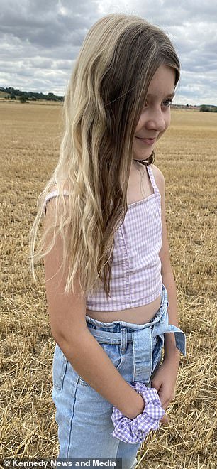 11-летняя девочка, родившаяся с двумя цветами волос