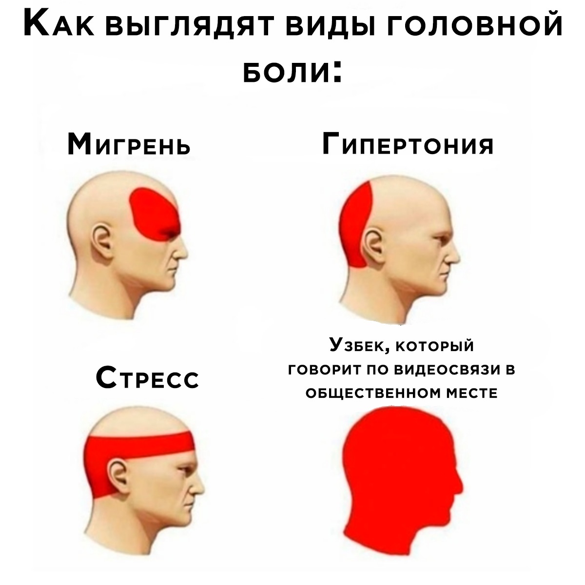 Причины головной боли картинки. Виды головной боли. Виды головной боли шутка. Виды головной боли Мем. Головная боль юмор.